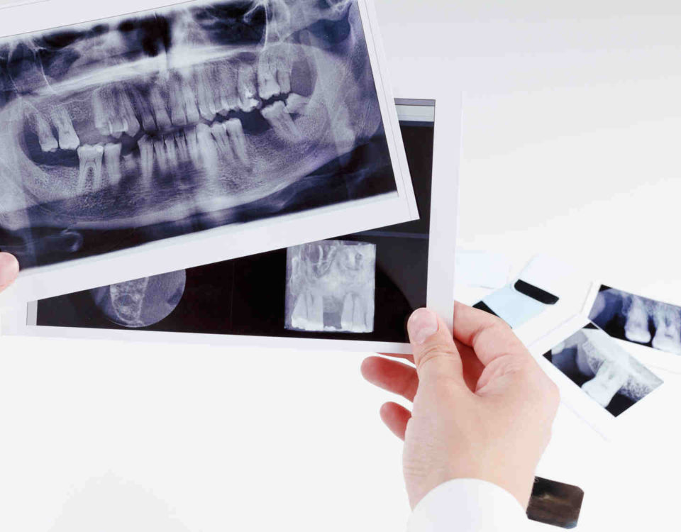 Dentysta Toruń - RTG zęba - gabinet stomatologiczny