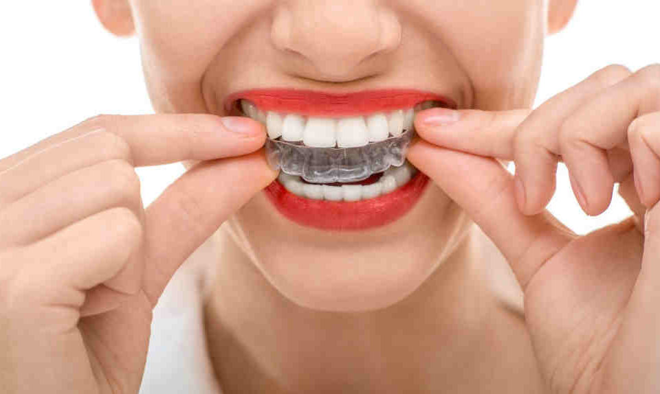wybielanie zębów toruń - Dentysta toruń stomatologia estetyczna